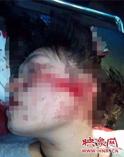 河南一年轻女医生被砍 身中七刀在ICU抢救(图)