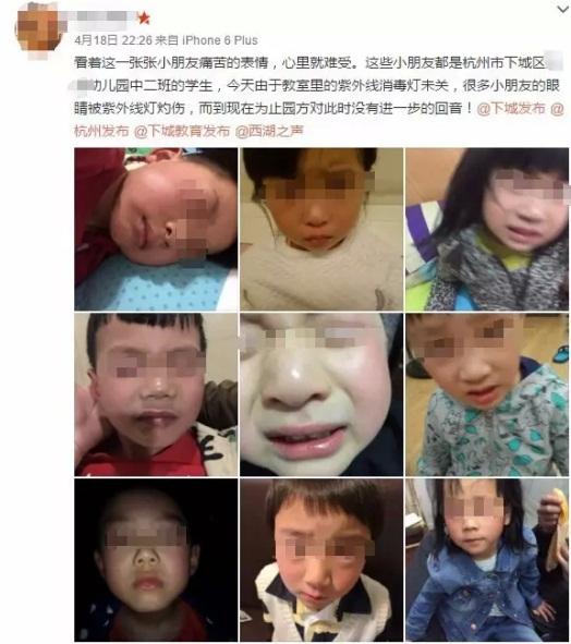 杭州一幼儿园忘关紫外线灯 多个孩子眼睛被灼伤